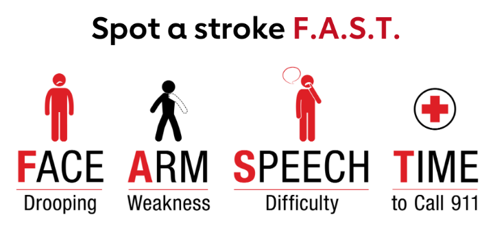 October 29th is World Stroke Day: Vermont neurologist and survivor urge everyone to learn the FAST warning signs