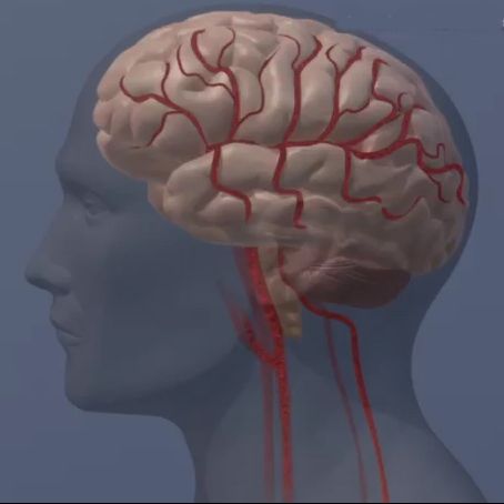 Depression common after stroke, says LifeBridge neurosurgeon Dr. William Ashley